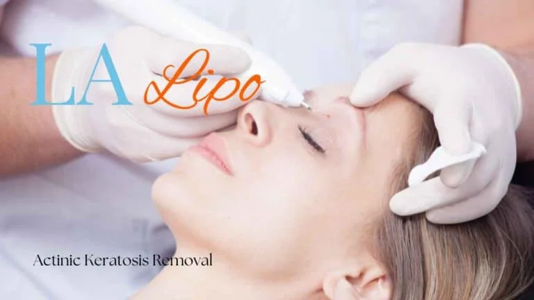 Woman receiving Actinic Keratosis Removal Treatment Maplehurst
