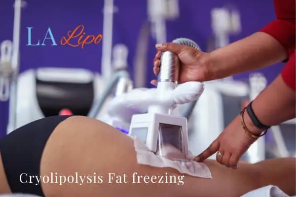 women getting fat freezing Maplehurst