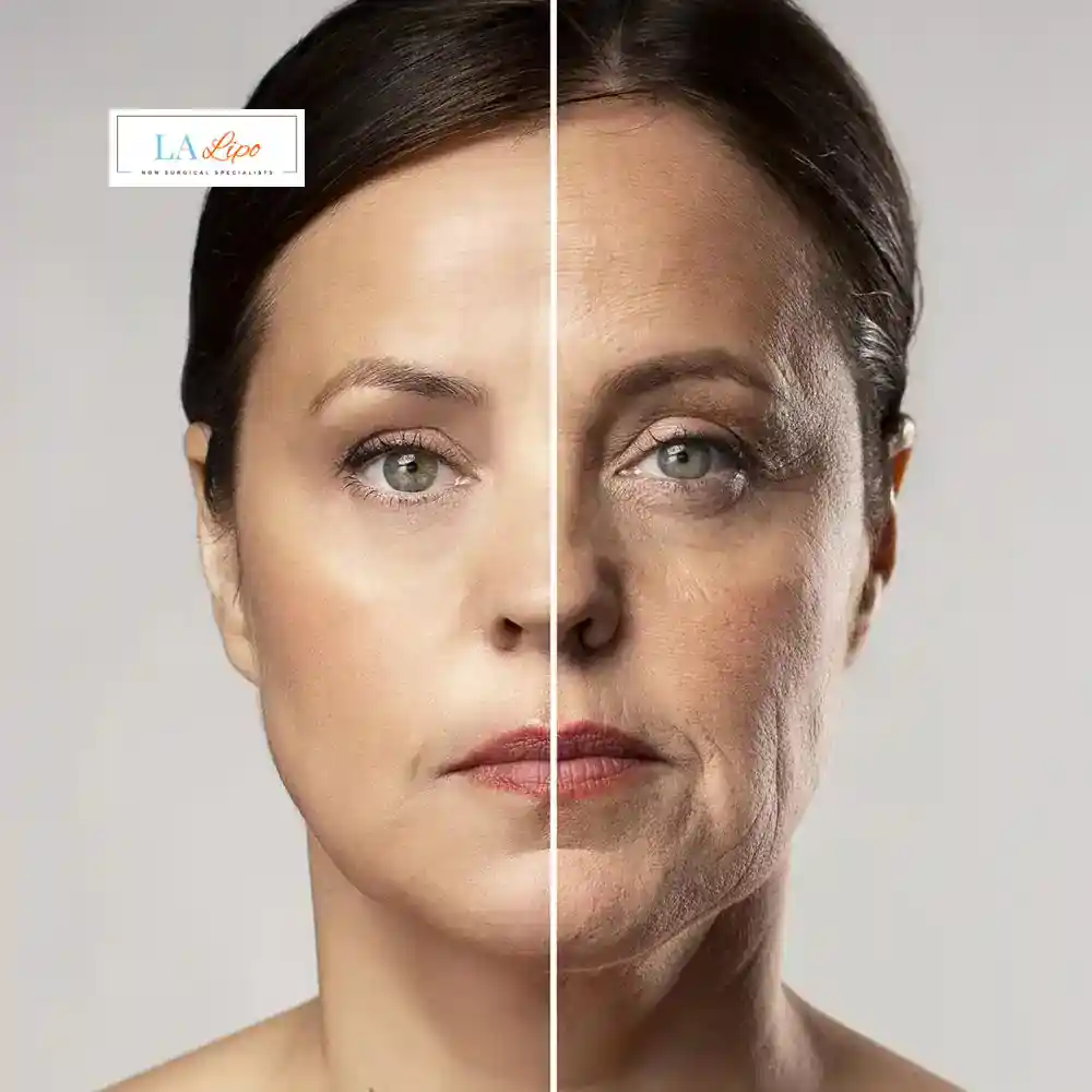 How Can You Tell If Non-Surgical Skin Tightening Is Right for You Maplehurst?