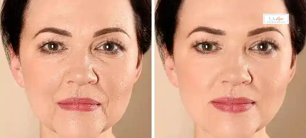 Why Aren’t My Skincare Products Making My Sagging Skin Look Firmer Maplehurst?