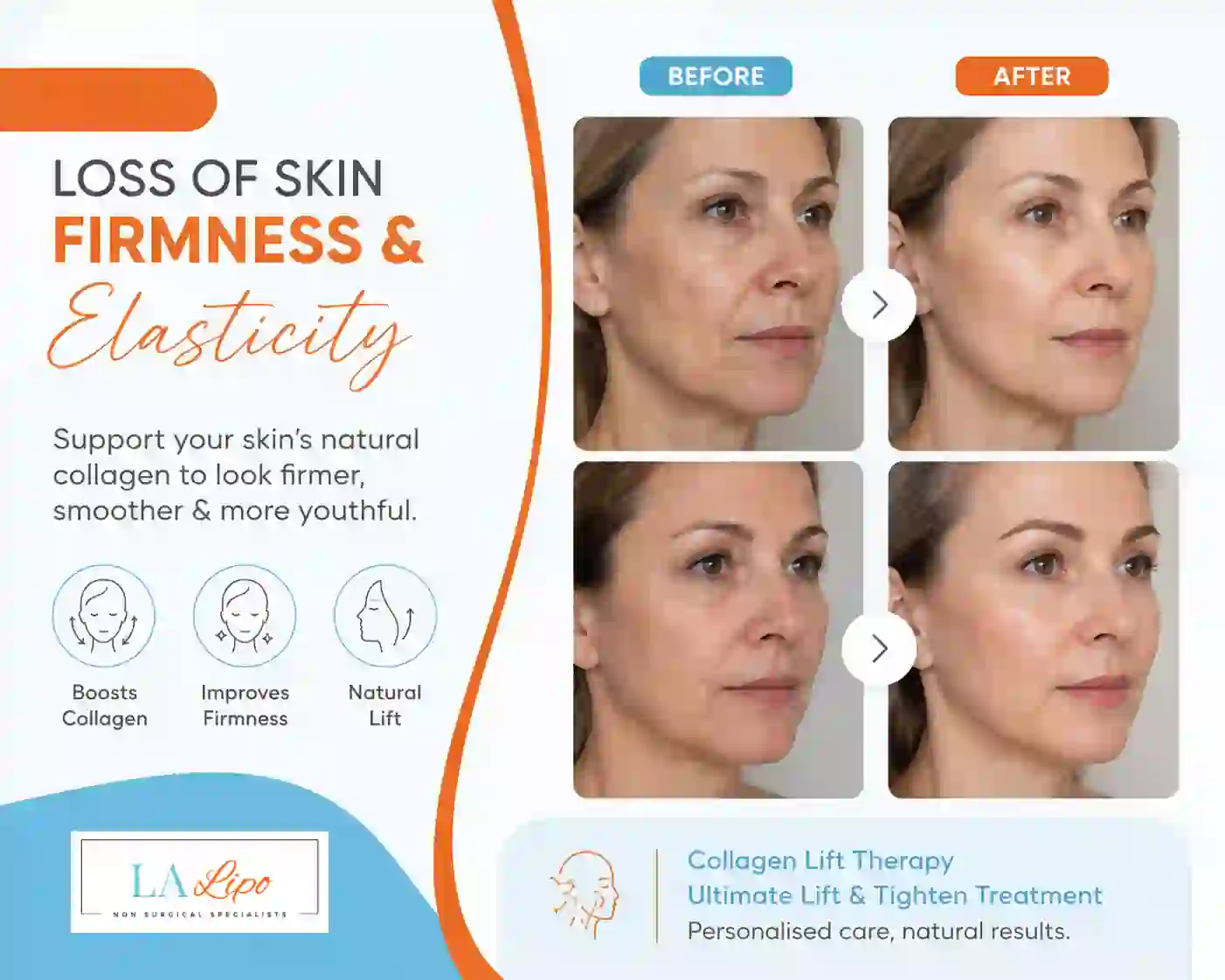 Sign #7: Loss of Skin Firmness and Elasticity Maplehurst