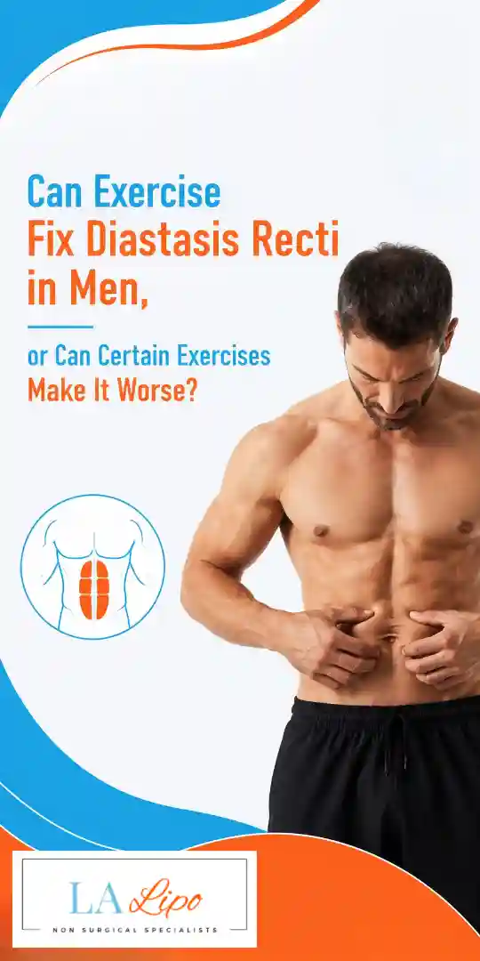 Can Exercise Fix Diastasis Recti in Men, or Can Certain Exercises Make It Worse Maplehurst?